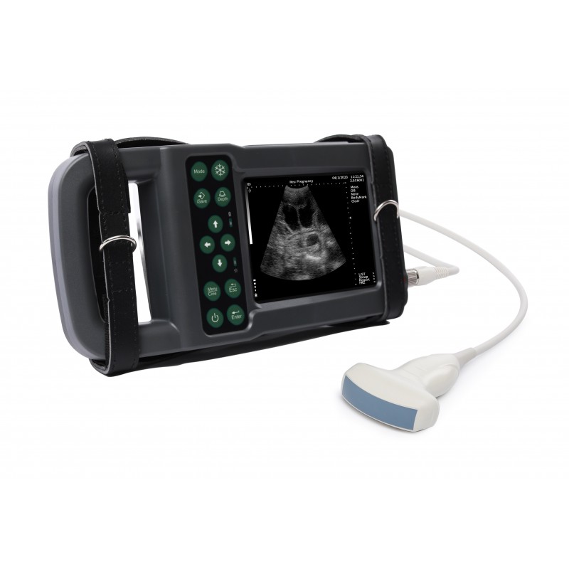 Ultrazvukový skener KX5600L s digitální abdominální sondou