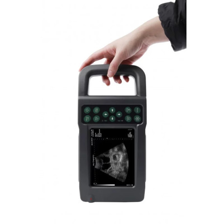 Ultrazvukový skener KX5600L s rektální sondou