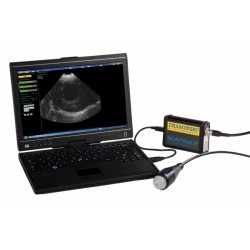 Ultrazvukový skener SonTrace, s abdominální sondou